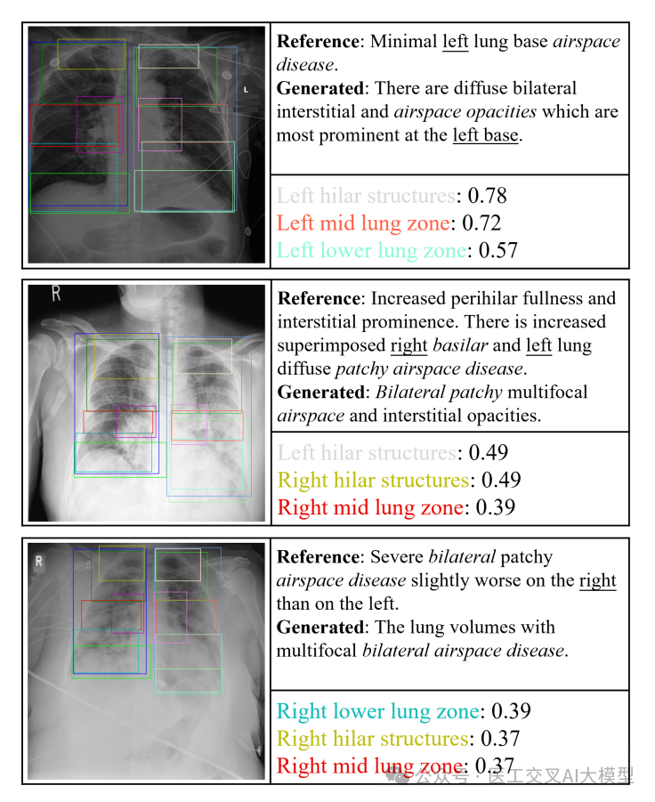 语言大数据创新实验班_语言大脑区域_LLM大语言